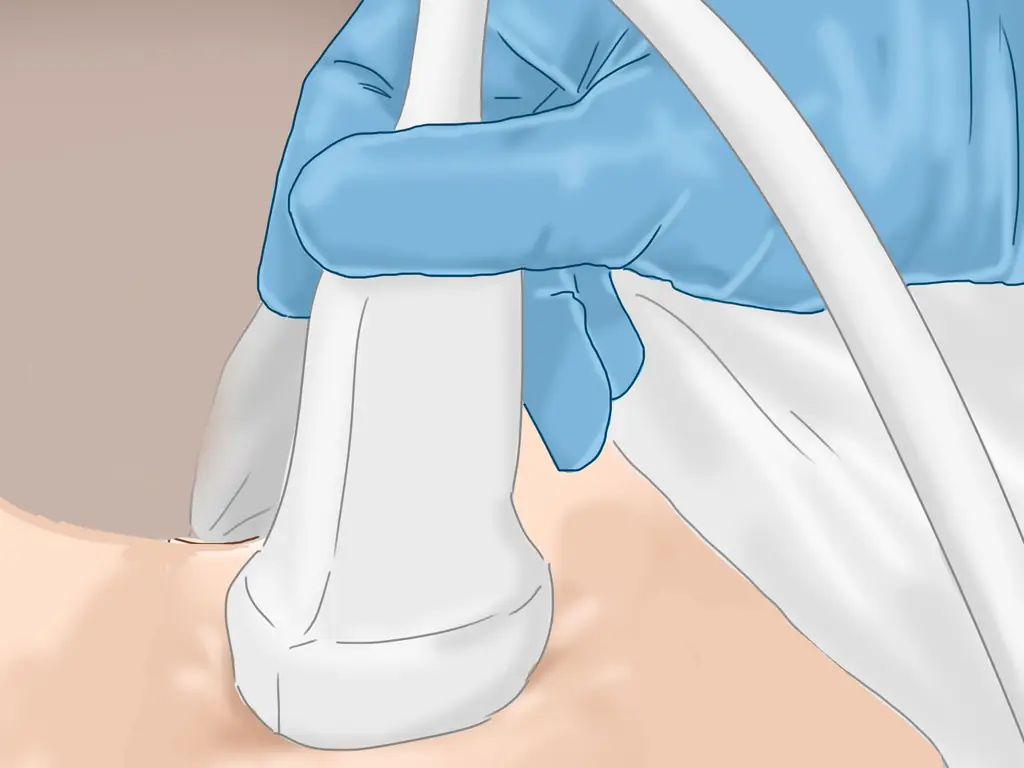 Как читать результаты теста щитовидной железы: 13 шагов (с картинками)