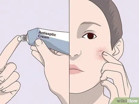 Лечить царапины на лице Шаг 5