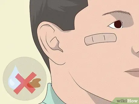 Лечить царапины на лице Шаг 8