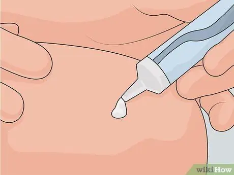 Удаление шрамов на ногах Шаг 13