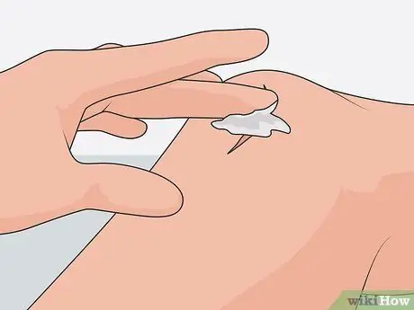 Удаление шрамов на ногах, шаг 02