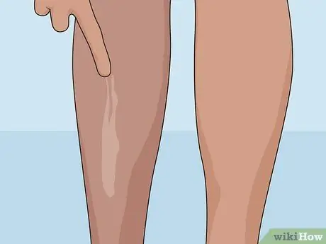 Удаление шрамов на ногах, шаг 06