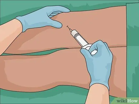 Удаление шрамов на ногах Шаг 20