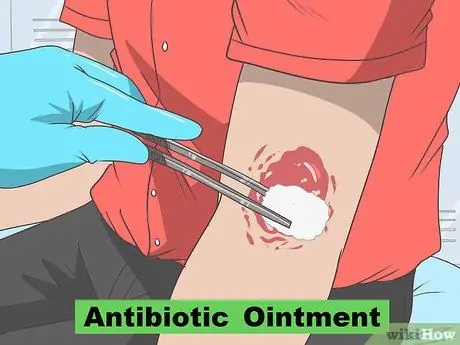 Лечить ожоги от подушки безопасности Шаг 6