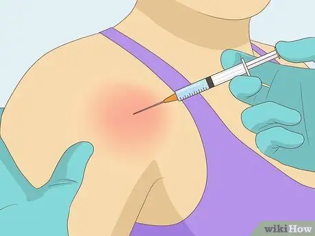 Выявление травмы вращательной манжеты плеча Шаг 15