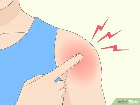 Выявление травмы вращательной манжеты плеча Шаг 2