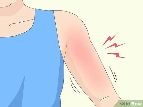 Выявление травмы вращательной манжеты плеча Шаг 3