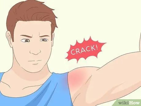 Выявление травмы вращательной манжеты плеча Шаг 5