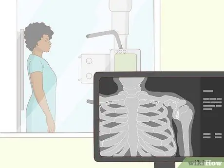 Выявление травмы вращательной манжеты плеча Шаг 8