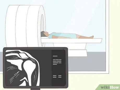 Выявление травмы вращательной манжеты плеча Шаг 9