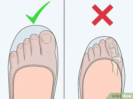 Поднимите ноги Шаг 11