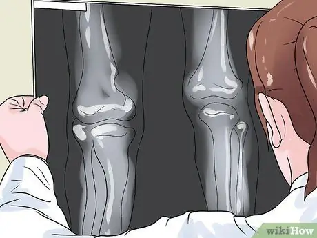 Как определить, короче ли одна нога Шаг 17