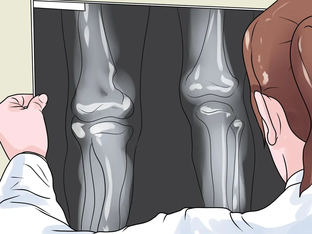 Как определить, что одна нога короче (с иллюстрациями)