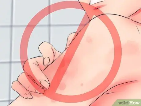 Лечить зудящую рану Шаг 7