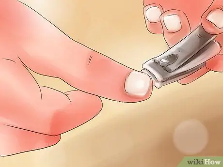 Лечить зудящую рану Шаг 8