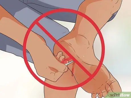 Обработать колотую рану Шаг 10