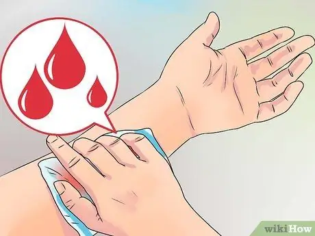 Очистите небольшую рану Шаг 2