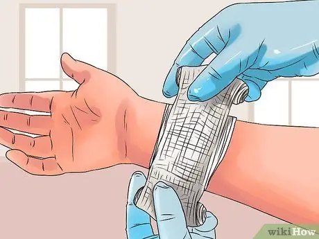 Очистите небольшую рану Шаг 5