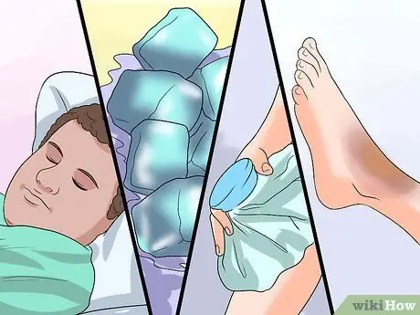 Исцелить гематому Шаг 1