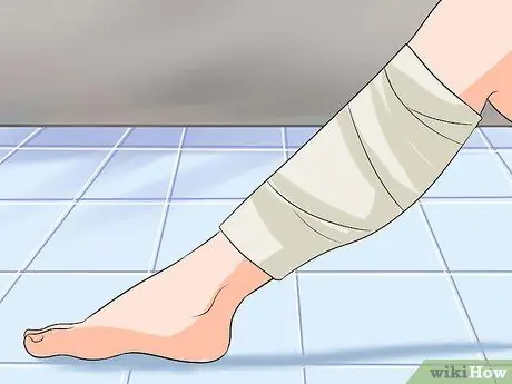 Вылечить гематому Шаг 4