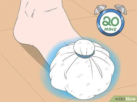 Исцеление ушиба пальца ноги, шаг 1