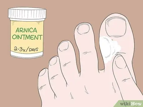 Исцеление ушиба пальца ноги Шаг 8