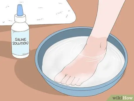 Исцеление ушиба пальца ноги Шаг 9