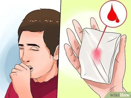 Распознайте симптомы аспергиллеза Шаг 1