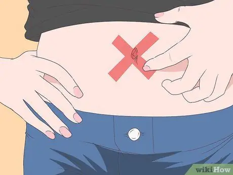 Лечите инфекцию в пупке Шаг 10