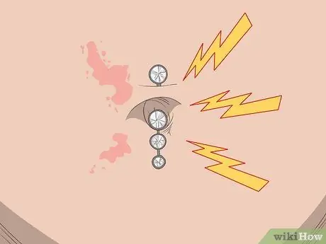 Лечите инфекцию в пупке Шаг 11