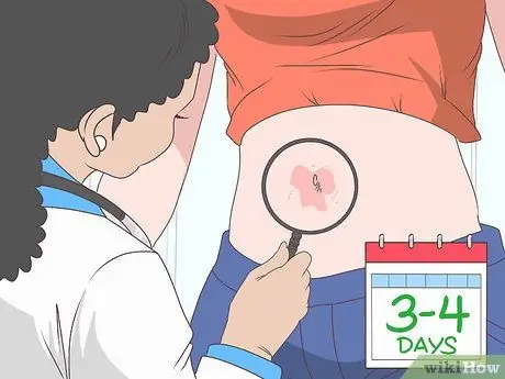 Лечите инфекцию в пупке Шаг 12