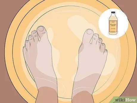 Избавиться от грибка стопы дома Шаг 08