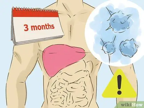 Помогите кому-нибудь выздороветь после трансплантации печени Шаг 11