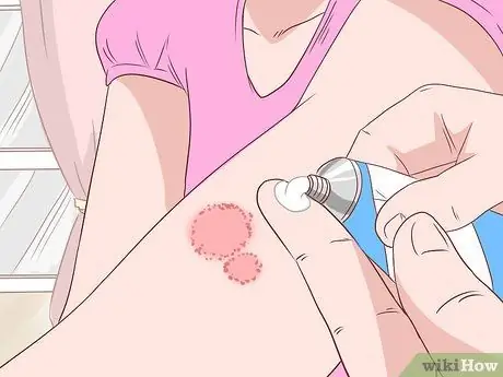 Предотвратить кожный грибок Шаг 16