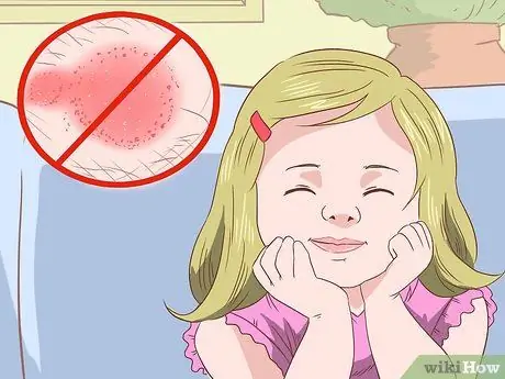 Предотвратить кожный грибок Шаг 6