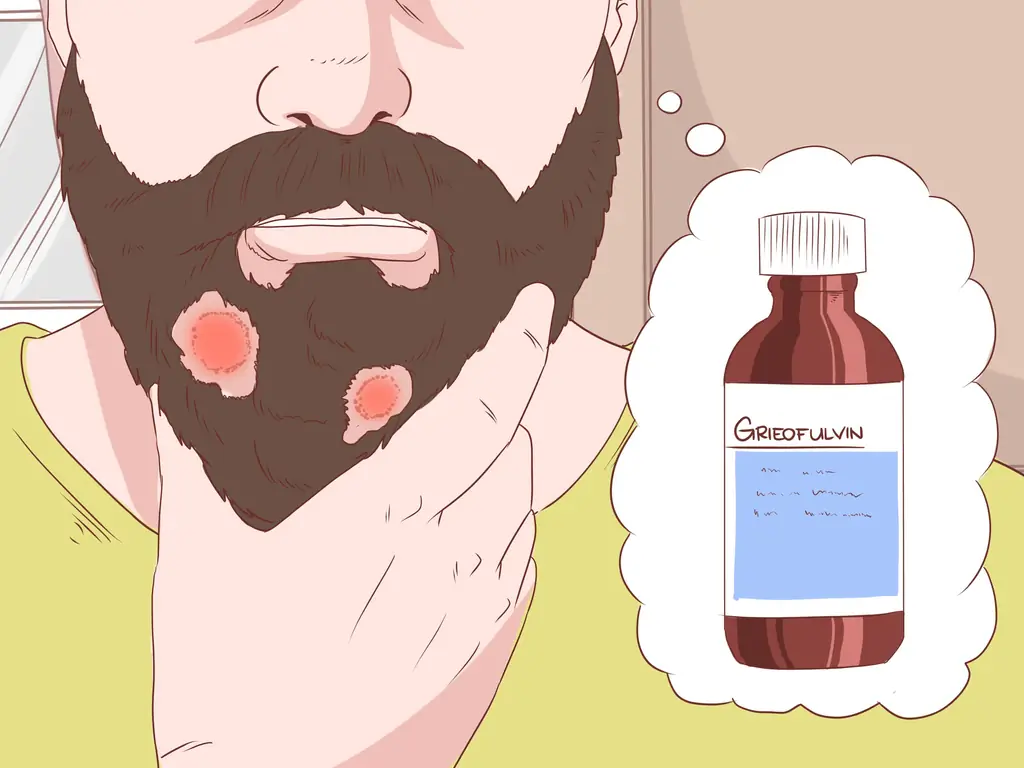 Как предотвратить кожный грибок (с иллюстрациями)