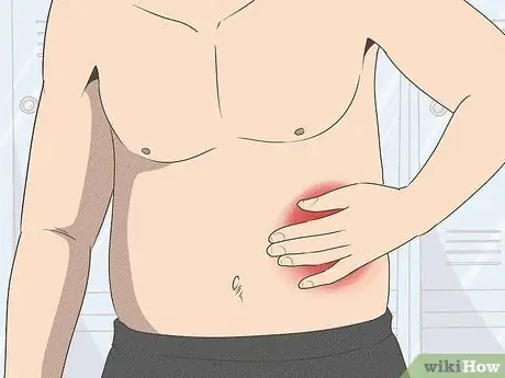 Дифференцировать бактериальный тонзиллит и вирусный тонзиллит Шаг 6