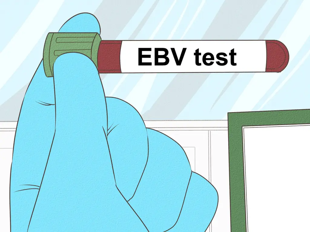 3 способа отличить бактериальный тонзиллит от вирусного тонзиллита