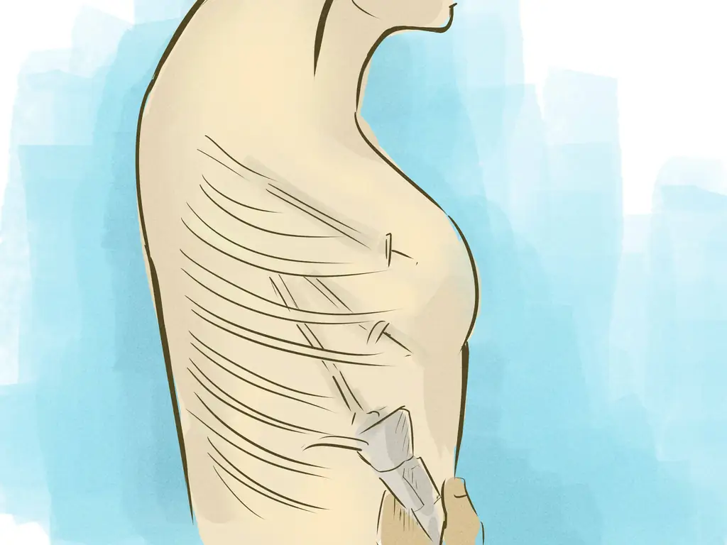 Как бороться с гипергидрозом или гипергидрозом (чрезмерным потоотделением)