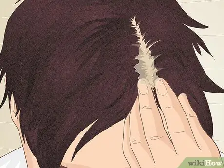 Шишки на коже головы. Шаг 17