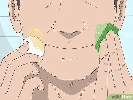 Лечить периоральный дерматит Шаг 7