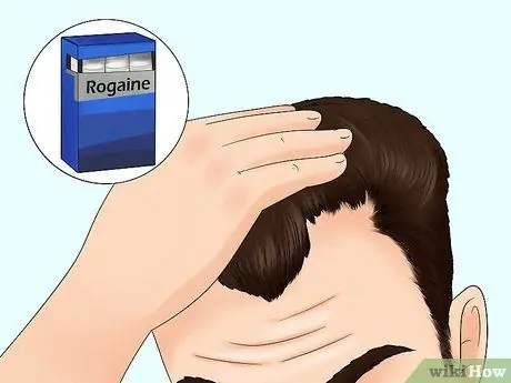 Устранение залысин Шаг 1