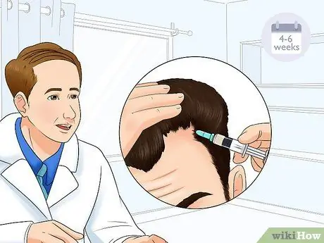 Устранение залысин Шаг 3