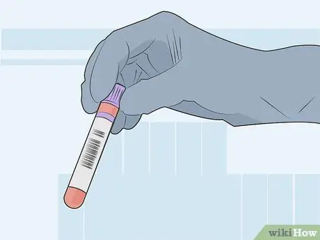 Диагностика болезни груди у мужчин, шаг 07