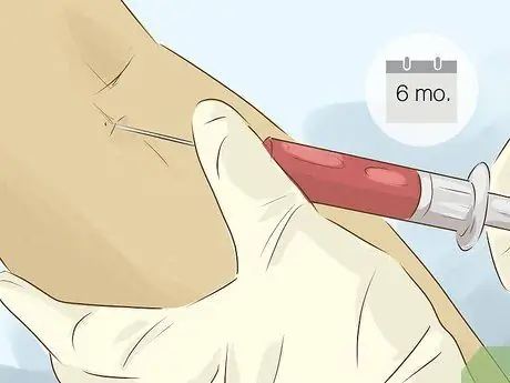 Лечить гипертиреоз у мужчин Шаг 4