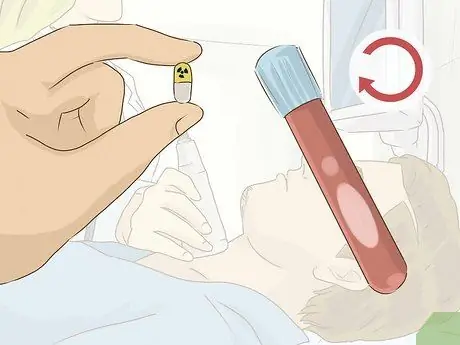 Лечить гипертиреоз у мужчин Шаг 5