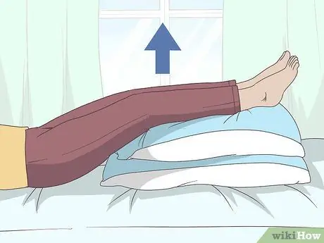 Лечить эпидидимит Шаг 5