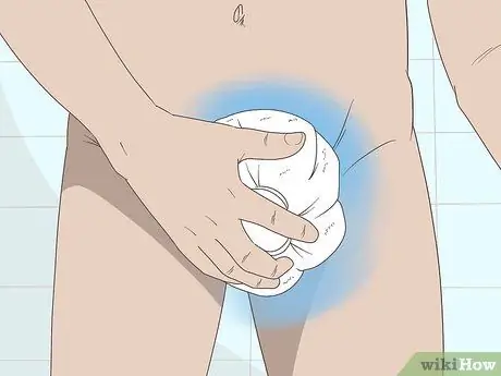 Лечить эпидидимит Шаг 7