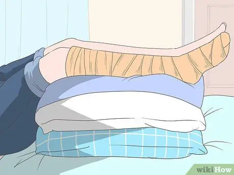 Уменьшить отек после операции Шаг 1