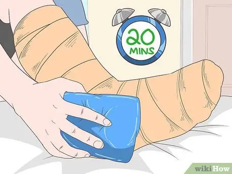 Уменьшить отек после операции Шаг 2